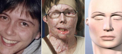 I 2007 dynket eks-mannen Carmen (44) i lut, nå har hun endelig fått sitt nye ansikt